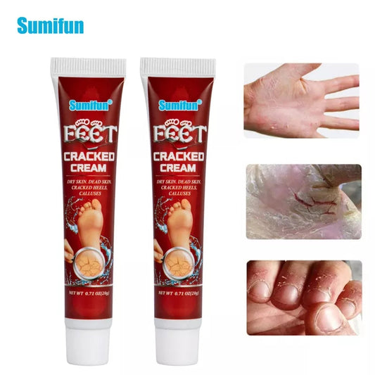Cracked Hands and Feet Cream | Skin Ointment for Cracked Heels, Dry Skin and Dead Skin