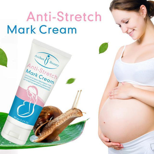 Anti-Stretch Marks Cream | Stretch Marks Removal Cream