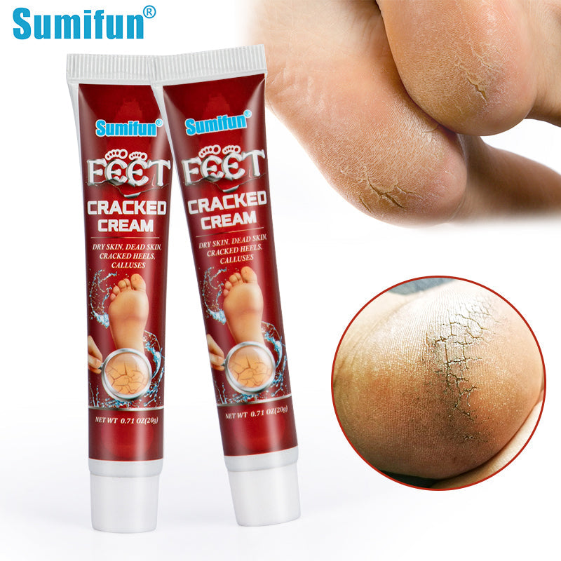 Cracked Hands and Feet Cream | Skin Ointment for Cracked Heels, Dry Skin and Dead Skin