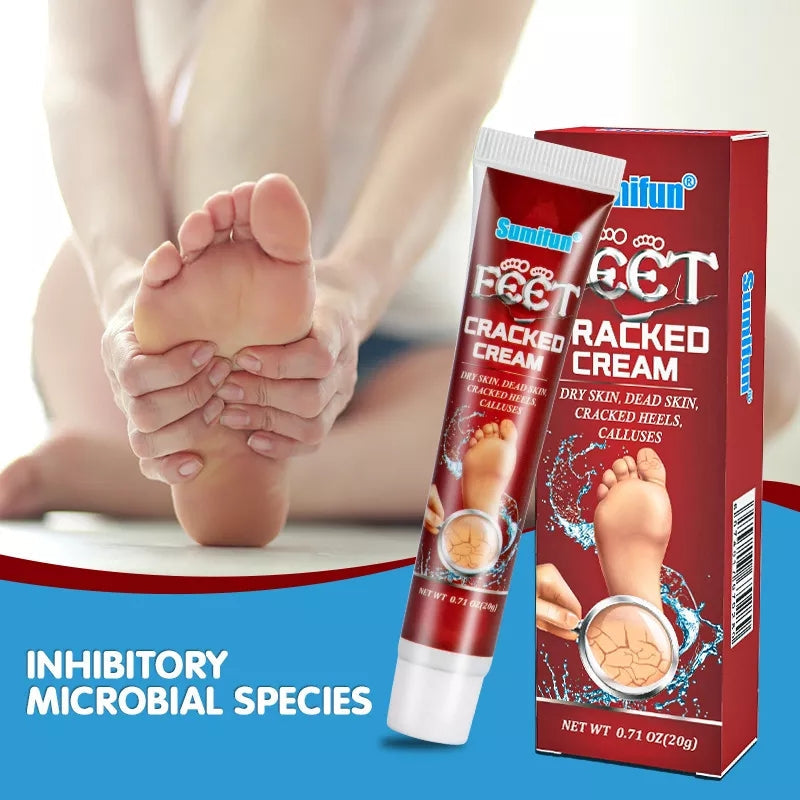 Cracked Hands and Feet Cream | Skin Ointment for Cracked Heels, Dry Skin and Dead Skin