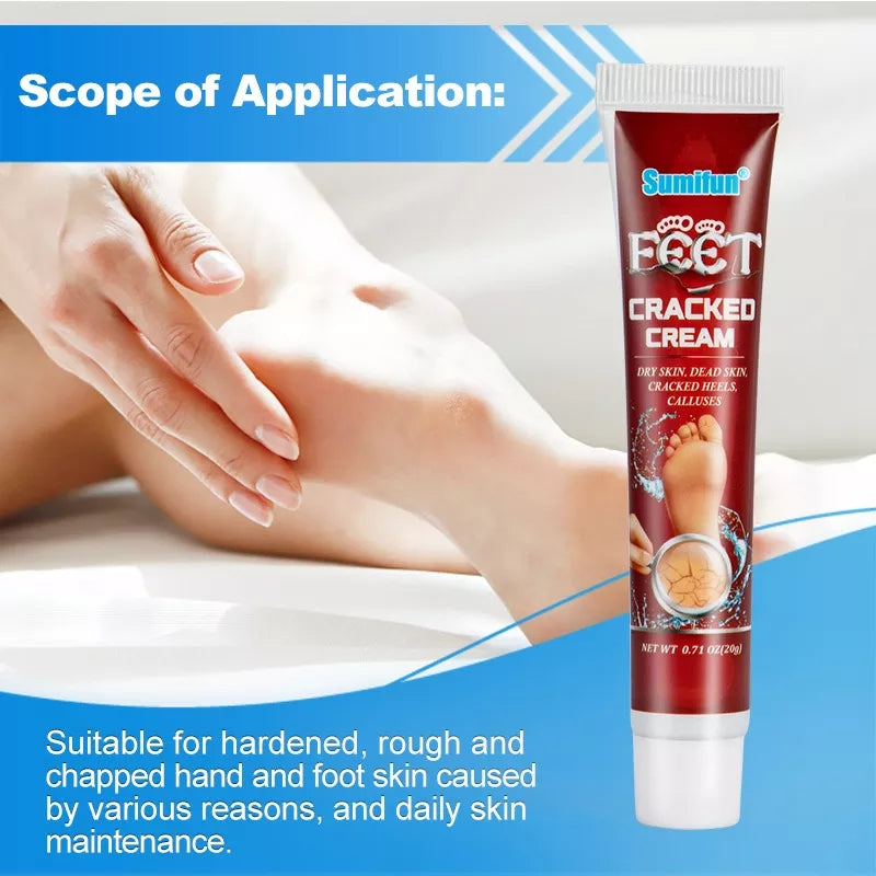 Cracked Hands and Feet Cream | Skin Ointment for Cracked Heels, Dry Skin and Dead Skin
