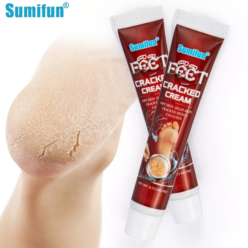Cracked Hands and Feet Cream | Skin Ointment for Cracked Heels, Dry Skin and Dead Skin