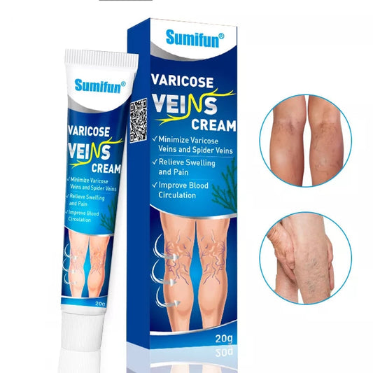Varicose Veins Cream | Herbal Cream for Spider Veins and Varicose Veins