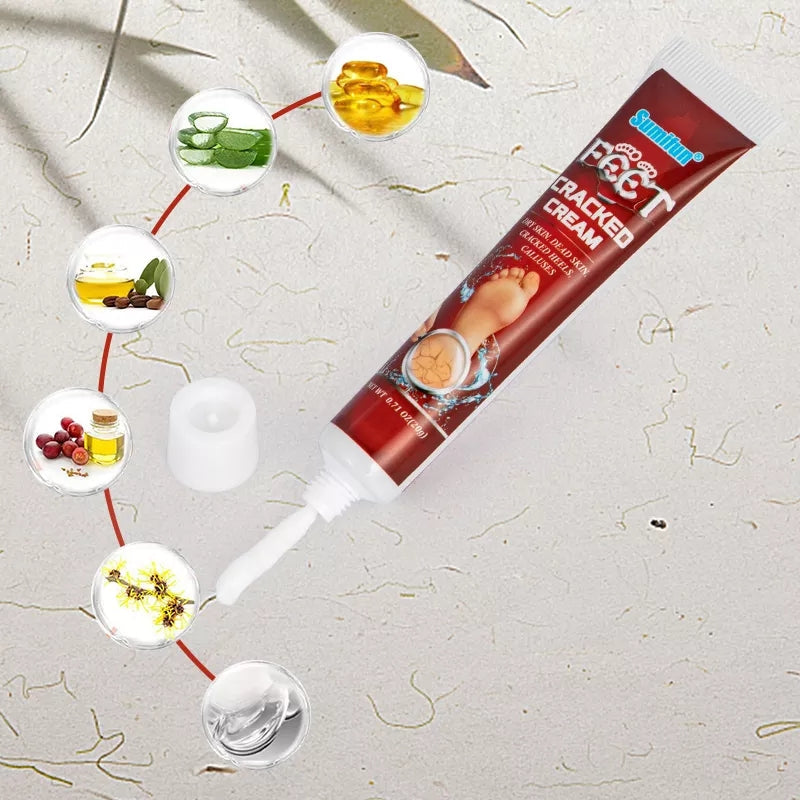 Cracked Hands and Feet Cream | Skin Ointment for Cracked Heels, Dry Skin and Dead Skin