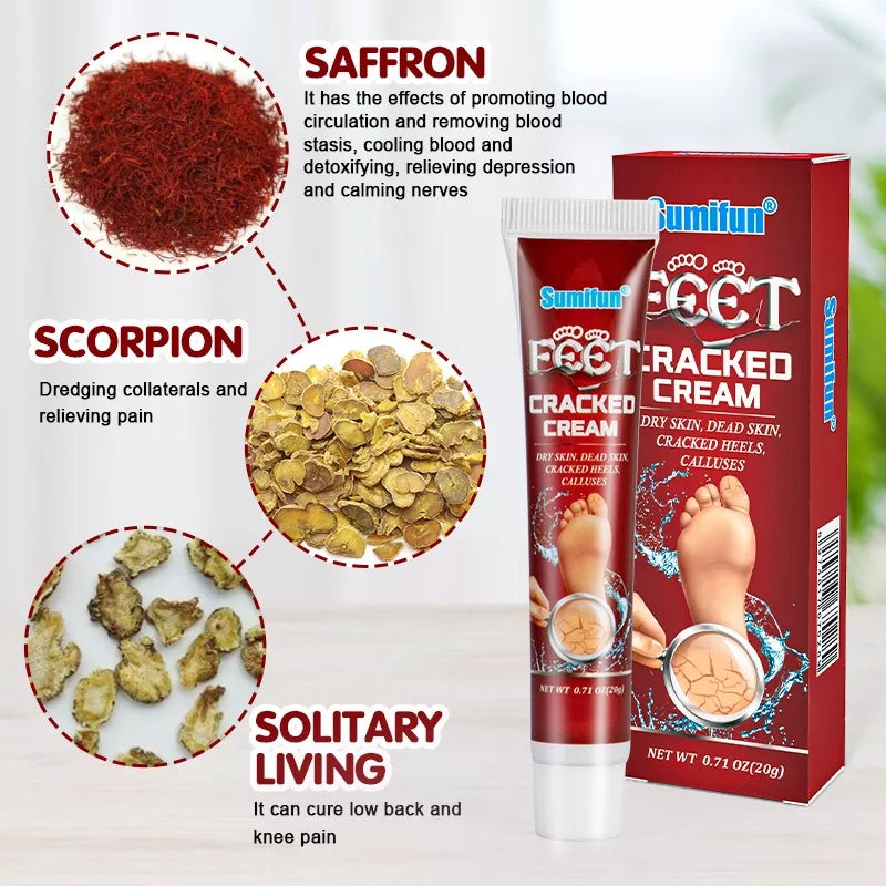 Cracked Hands and Feet Cream | Skin Ointment for Cracked Heels, Dry Skin and Dead Skin