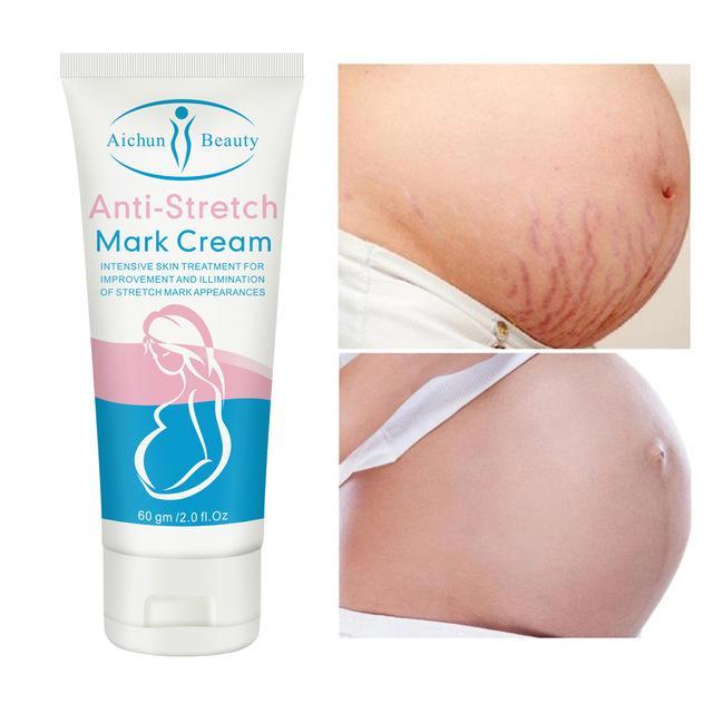 Anti-Stretch Marks Cream | Stretch Marks Removal Cream