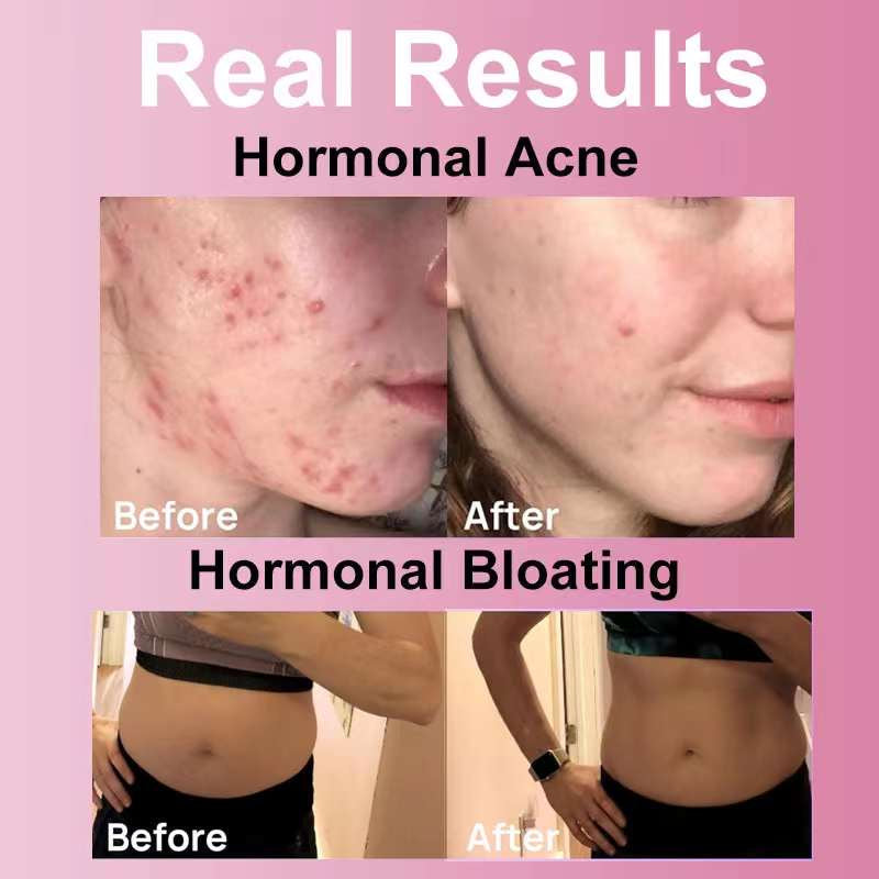 PMS Relief and Hormonal Balance Gummies | Dietary Supplement for Cramping, Bloating, and Mood Swing