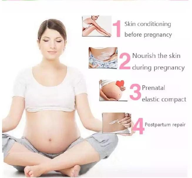 Anti-Stretch Marks Cream | Stretch Marks Removal Cream