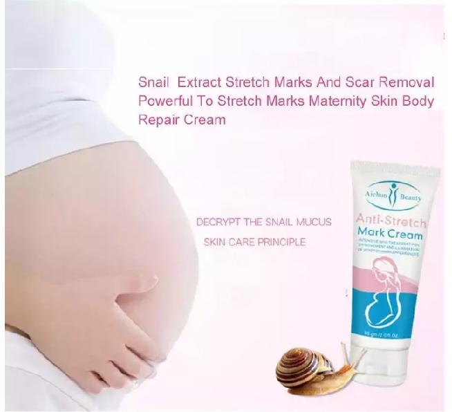 Anti-Stretch Marks Cream | Stretch Marks Removal Cream
