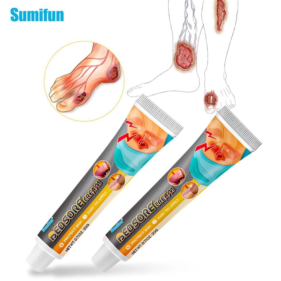 Bed Sores Cream | Herbal Ointment for Decubitus Ulcers, Wound Healing, and Pressure Ulcers