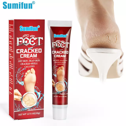 Cracked Hands and Feet Cream | Skin Ointment for Cracked Heels, Dry Skin and Dead Skin
