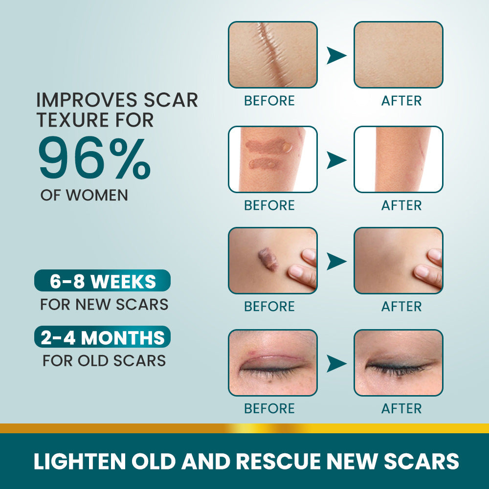 Silicone Scar Cream (30 grams) | Topical Cream for Old and New Scars