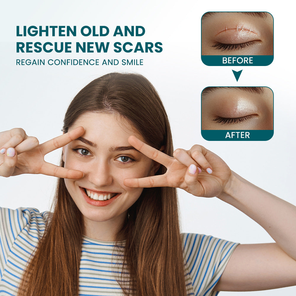 Silicone Scar Tape (Extra long, 4×300cm, White color) | Scar Repair Sheet for New & Old Scars and Stretch Marks