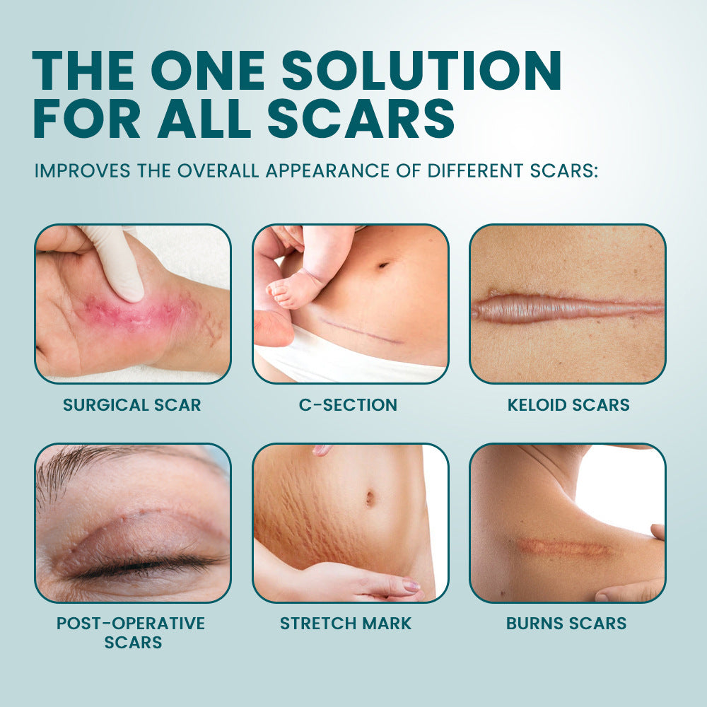 Silicone Scar Cream (30 grams) | Topical Cream for Old and New Scars