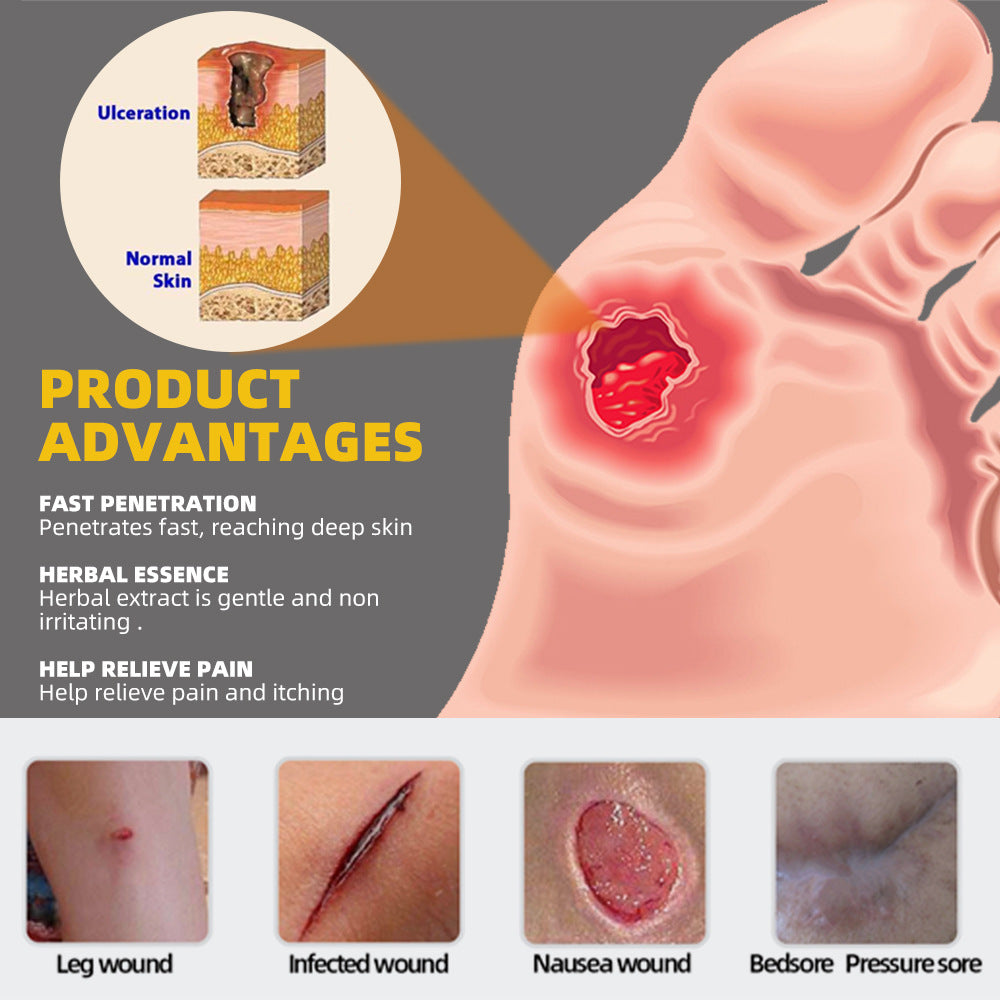 Bed Sores Cream | Herbal Ointment for Decubitus Ulcers, Wound Healing, and Pressure Ulcers