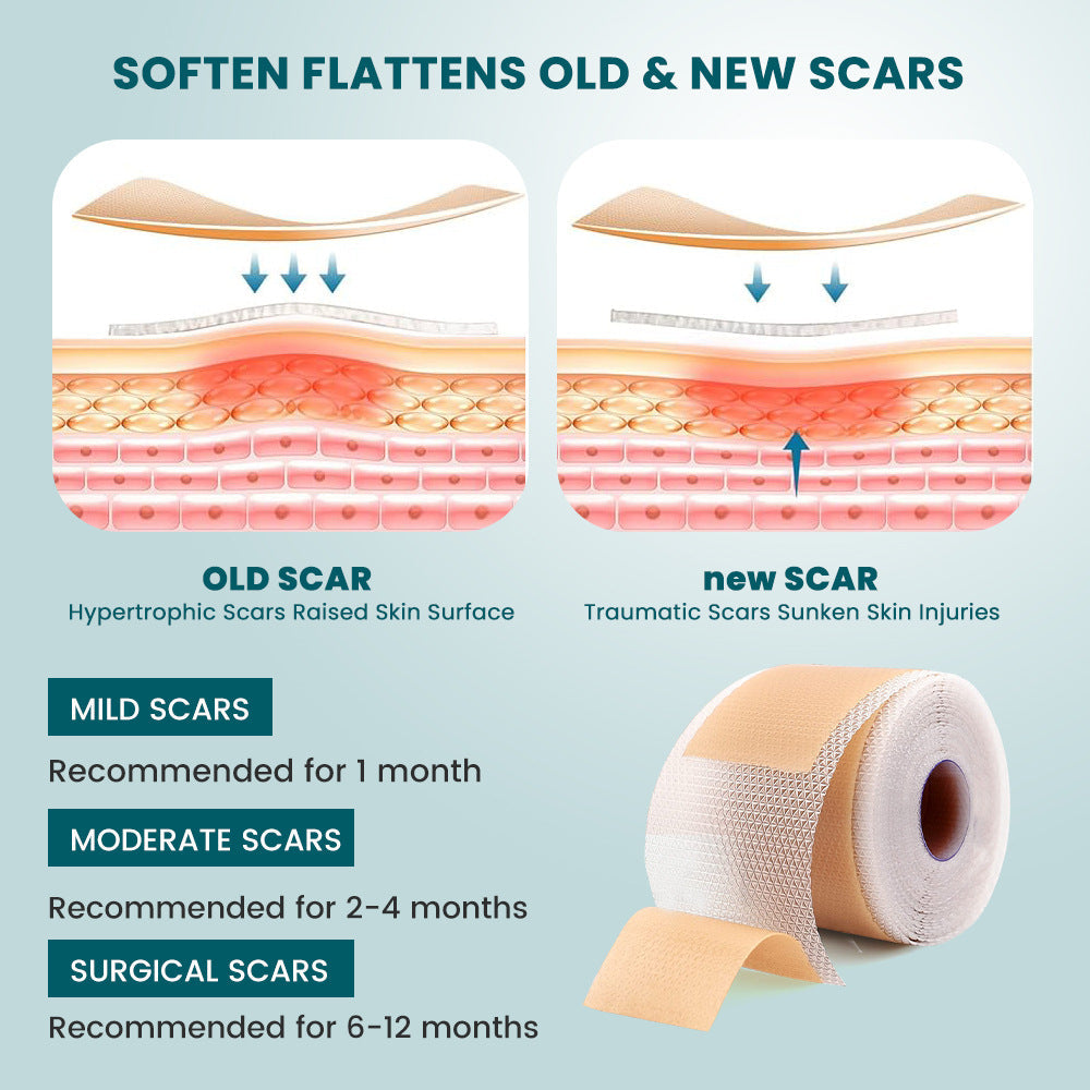 Silicone Scar Tape (Extra long, 4×300cm, White color) | Scar Repair Sheet for New & Old Scars and Stretch Marks